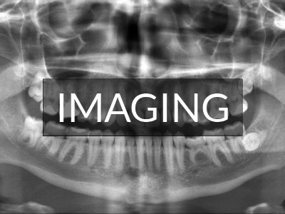 Intraoral Imaging